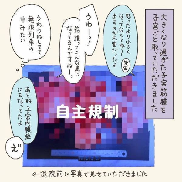 子宮全摘！疲れやすいのは加齢のせいじゃなかった／40代婦人科トラブル#1