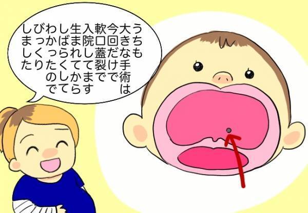 いろいろな症例があるんだ…！プレイルームで出会った口唇口蓋裂のお友達