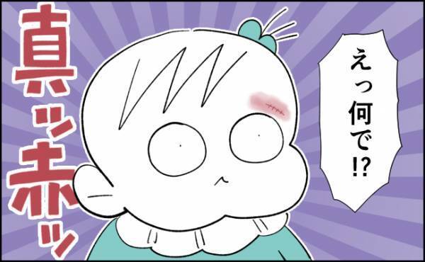 えっ…手術の傷のところが真っ赤じゃん！！かぶれた原因って、まさか…？