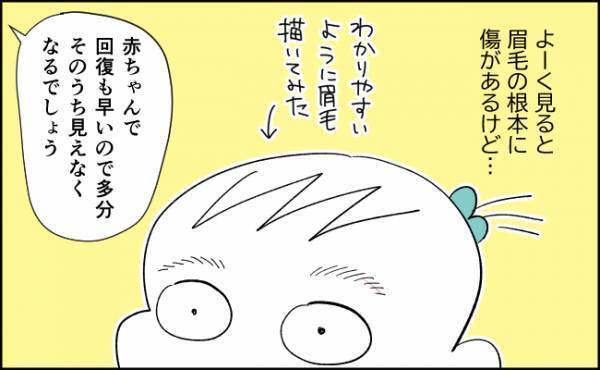 退院から10日後、病院を再受診！抜糸はチャチャッとスムーズに終了！