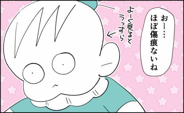 わが子が4歳になった今思うこと…あのとき手術しておいて本当よかった！