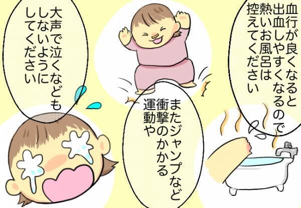 抜糸手術の約束ごとのハードルが高すぎる！説明を受けるも不安しかなく…