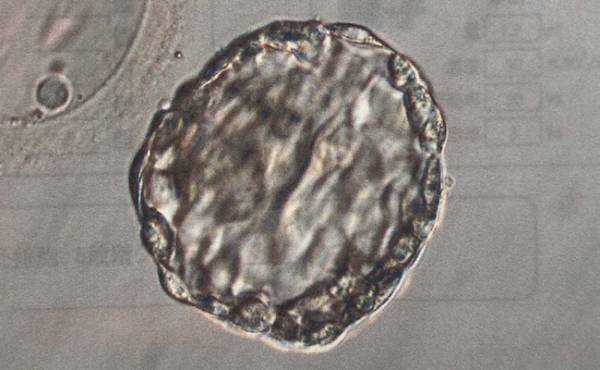 不妊の原因は私の体の不調？2人目不妊の治療を進めた結果わかったこと【体験談】