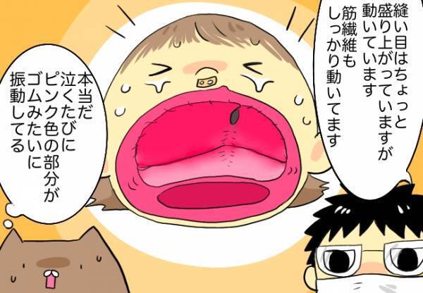 泣きながらも抜糸手術が無事終了。意外な行動をとった娘に成長を感じて…