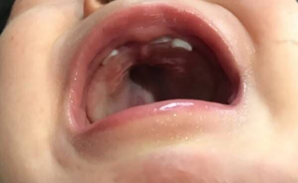 え 大丈夫かな 0歳児の乳歯 真ん中ではなく隣の歯から生えてきた 21年9月23日 ウーマンエキサイト 1 2