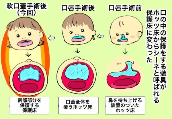 保護床が変わり、新たな問題が発生！今まで以上に気を付けるべきこととは