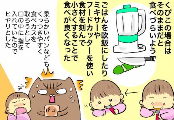 口蓋手術後の食生活の注意点とは？日常生活で気を付けていたこと