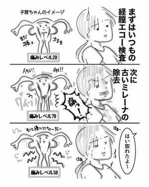 噂の「ミレーナ」を交換！痛みは？費用は？【子宮内膜症入院＃その後】