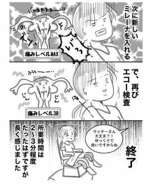 噂の「ミレーナ」を交換！痛みは？費用は？【子宮内膜症入院＃その後】