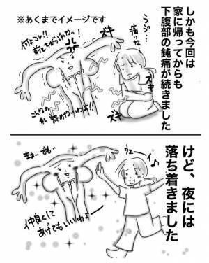 噂の「ミレーナ」を交換！痛みは？費用は？【子宮内膜症入院＃その後】