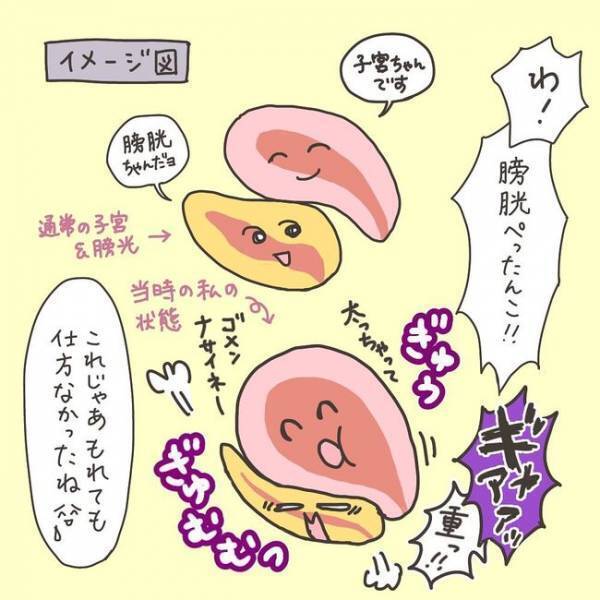 「膀胱ぺったんこ！」MRIで見た筋腫の状態に驚き！／40代婦人科トラブル#27