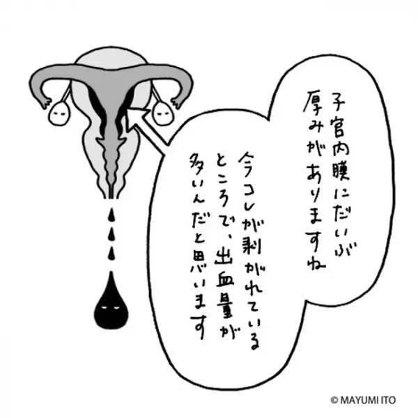 「無理です！」おなじみの検査に悶絶…まさかの指摘まで！？／卵巣嚢腫日記。#3