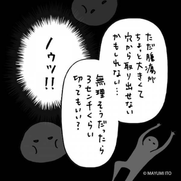 「切ってもいい？」ガーン！手術を勧めざるを得ないと言われ…／卵巣嚢腫日記。#8