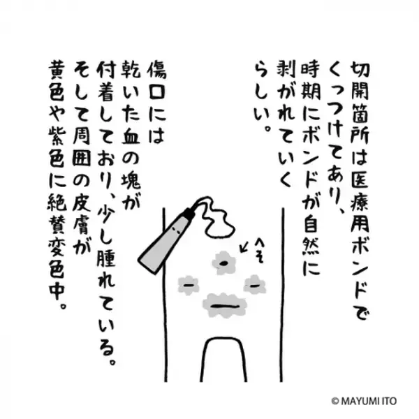 「見たくないが見るしか…」恐る恐る直視したものは…／卵巣嚢腫日記。#27