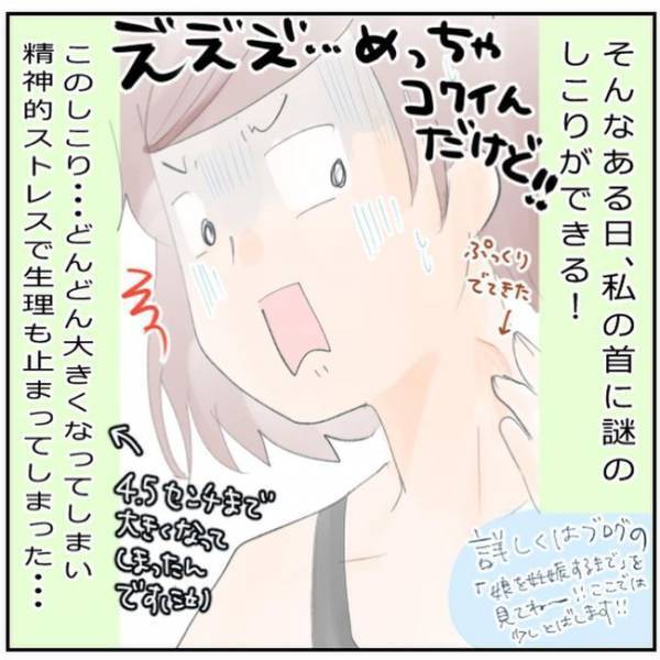 首にしこり！？ストレスで生理も止まり…／生理不順でしたが妊娠しました1