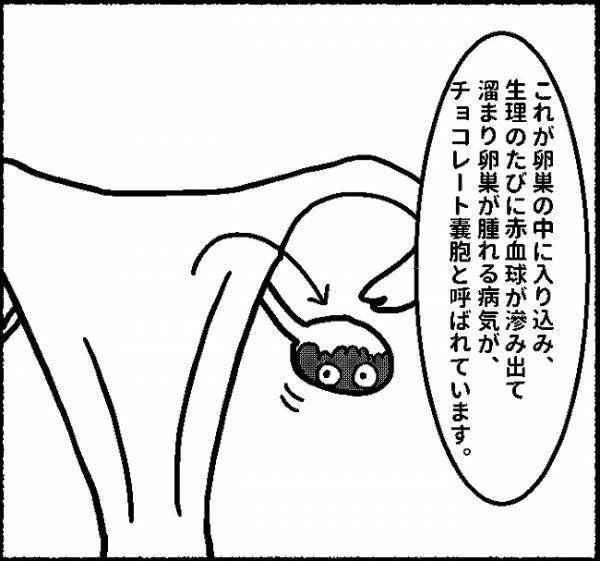 「自然治癒はない...」選択肢は2つ…！ #子宮内膜症日記 9