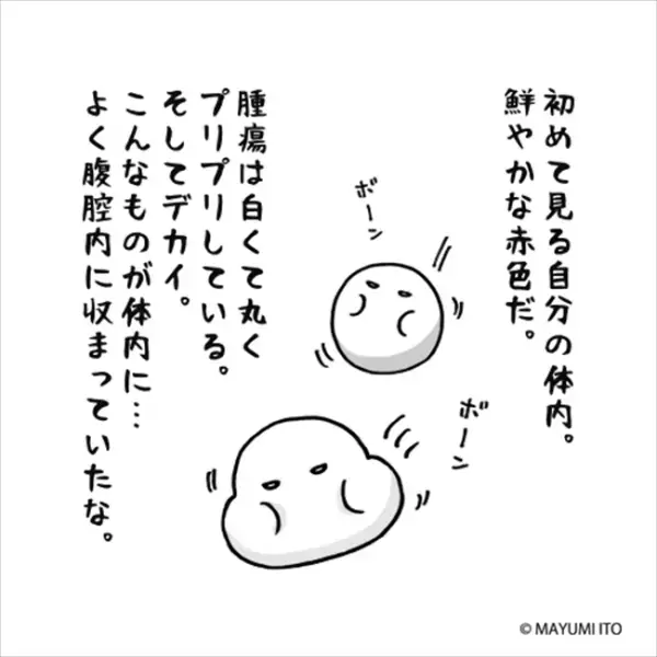 「白くてデカい…」こんなものが体内に！医師に見せられたのは…／卵巣嚢腫日記。#31