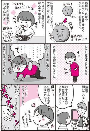 「さ、3個！？」子宮筋腫持ちの私が妊娠。そして異変が起こった！#子宮筋腫合併妊娠 1