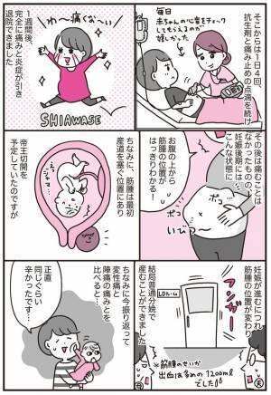 「痛み止めが効かない！？」そして入院！おなかの形がいびつに… #子宮筋腫合併妊娠 3