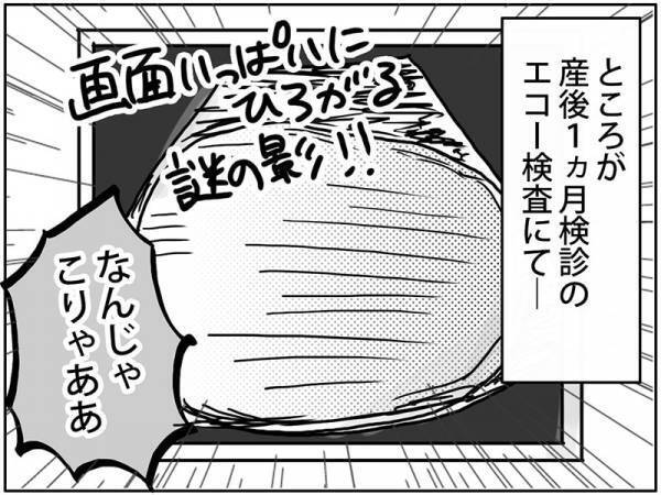 「なんじゃこりゃああ！！」産後1カ月健診で謎の影…！？ #卵巣ボーダーライン 1