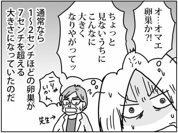 「なんじゃこりゃああ！！」産後1カ月健診で謎の影…！？ #卵巣ボーダーライン 1