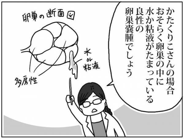 「良性？それとも悪性？」精密検査でわかったのは… #卵巣ボーダーライン 3