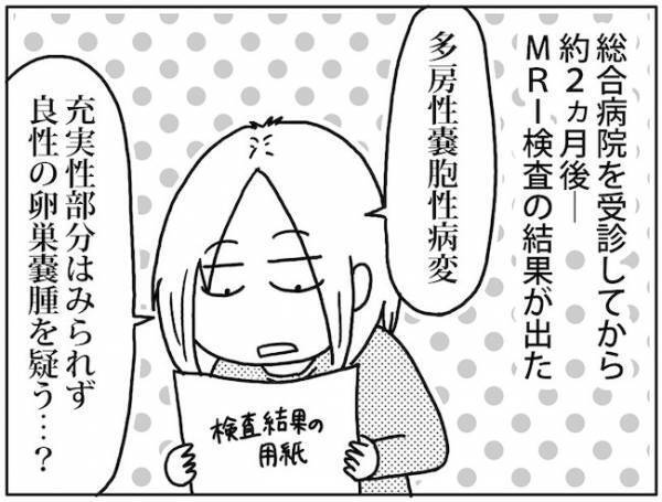 「良性？それとも悪性？」精密検査でわかったのは… #卵巣ボーダーライン 3