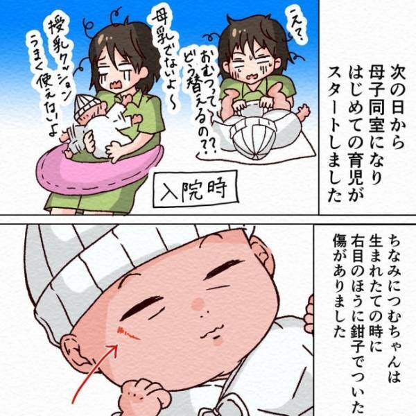 「心配。赤ちゃんの顔にキズが…！」しかし1カ月後に確認すると、先生の言った通りで… #無痛分娩 最終話