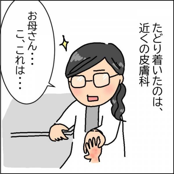 赤く腫れ「痛いよぉ」と泣く娘…原因はコロナ禍特有の習慣だった！？