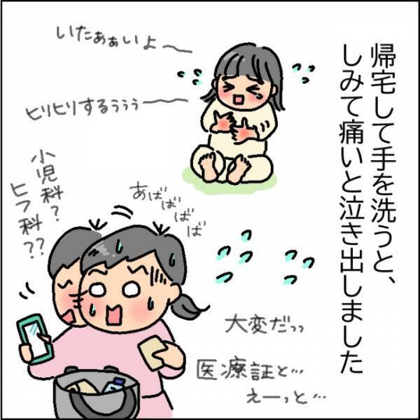 赤く腫れ「痛いよぉ」と泣く娘…原因はコロナ禍特有の習慣だった！？