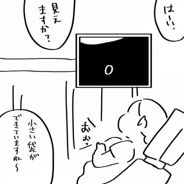 医師「赤ちゃんが小さくて…」頭がフリーズ！それってどういう意味！？ #夫を捨てたい 25