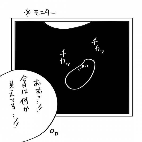 医師「心臓が止まるかもしれません」育たないってこと？冷酷な告知に背筋がゾワッとした。 #夫を捨てたい 27