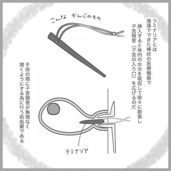 ついに手術当日！怯える妊婦が通されたのは残酷にもまさかの… #2度の流産の話 17