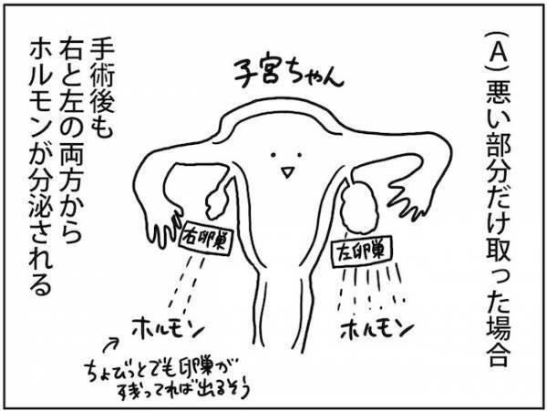 究極の2択！？卵巣嚢腫の手術法を選ぶ際の決め手は… #卵巣ボーダーライン 6