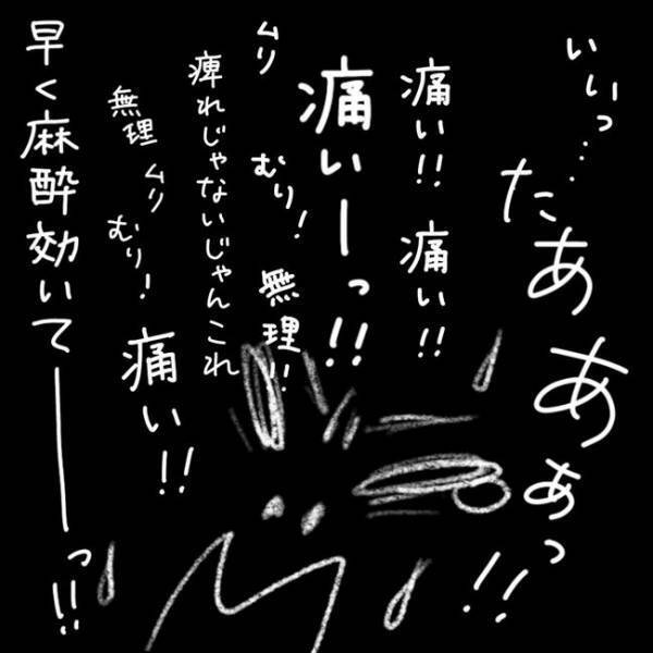 「いったぁぁぁい！」うそ、今？手術直前にまさかの激痛が！！  #40代婦人科トラブル 67
