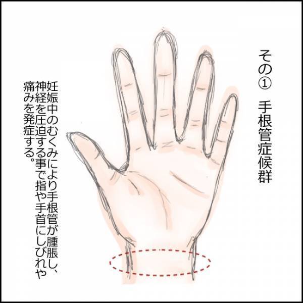 「心配いらないと思いますよ」医師に言われるも、頭痛、リンパ痛…。体のあちこちに異変が…【930グラムのいのち 4】