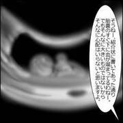 医師監修 妊娠中期のおなかの張りはガス 張る原因と対処法 ウーマンエキサイト 1 2