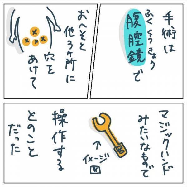 「手術するしかない」心を動かした、医師の言葉とは？ #手術中に目覚めた 3