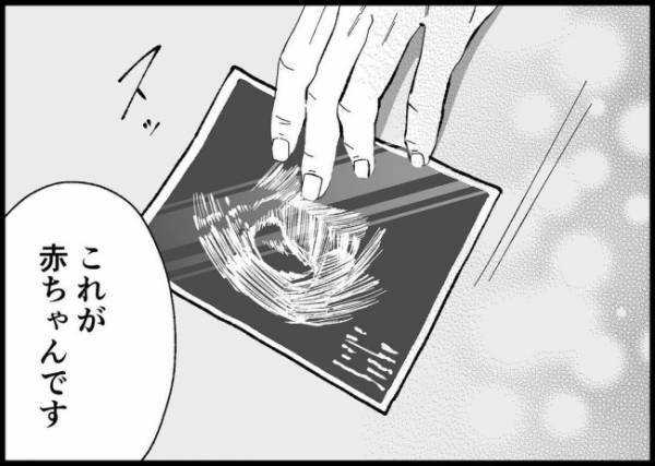 「赤ちゃんできたかも…」待ち望んだ妊娠。幸せな日々を確信していたのに… #僕と帰ってこない妻 161