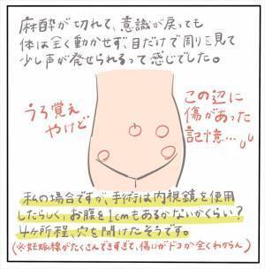 ＜女性特有トラブル＞「体が動かないし声も出ない」子宮内膜症の手術後は…？