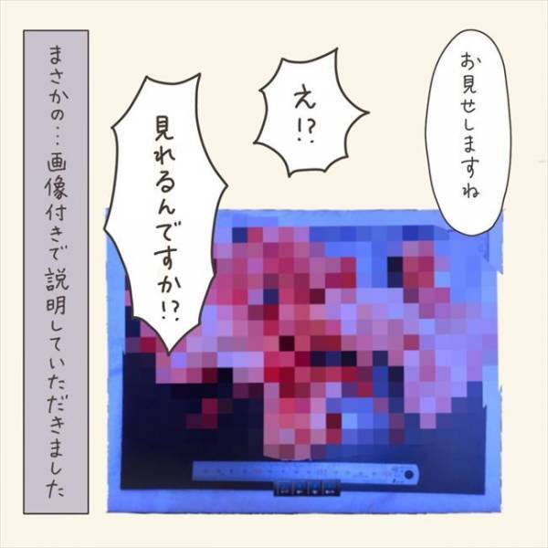 〈40代婦人科トラブル〉「実はハマってたんです」執刀医から衝撃の事実が！