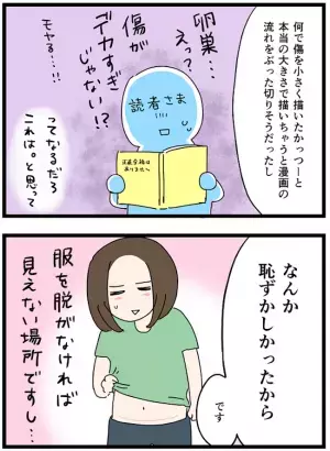 ＜卵巣が巨大化！？＞「突然ですが告白します」おなかにできた消えない傷。そのワケは…