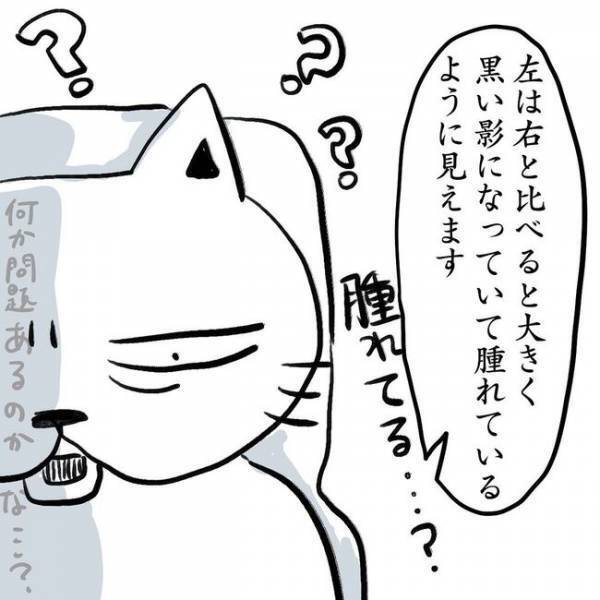 ＜卵巣のう腫体験談＞「ゾッとした」見つかったのは、私が予想もしていなかったモノで…！？