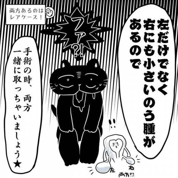 ＜卵巣のう腫体験談＞「レアケースです」検査結果に仰天！予想外の場所にのう腫が…！？