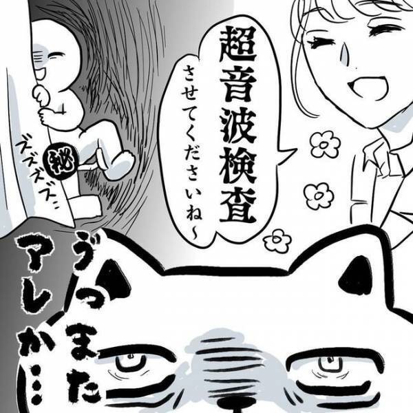 ＜卵巣のう腫体験談＞「レアケースです」検査結果に仰天！予想外の場所にのう腫が…！？