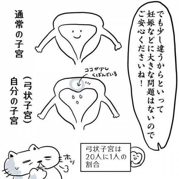 ＜卵巣のう腫体験談＞「そうだったの！？」つらい生理痛、原因はまさかの…