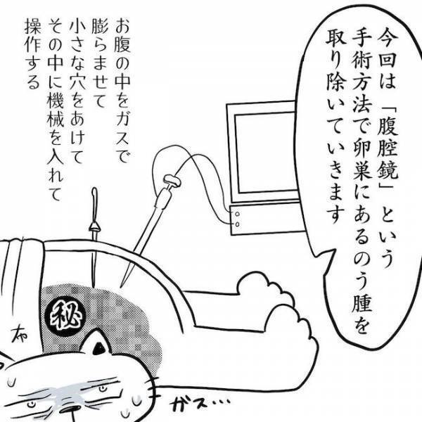 ＜卵巣のう腫体験談＞「ドキドキ」初手術、医師の言葉に冷や汗が止まらず…！？