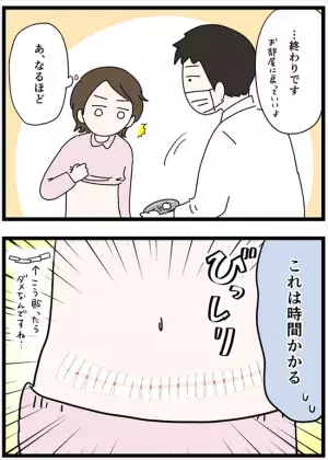＜卵巣が巨大化！？＞「何枚貼るんだ…？」ついに抜糸！気づいたら私の体はテープだらけになっていて…
