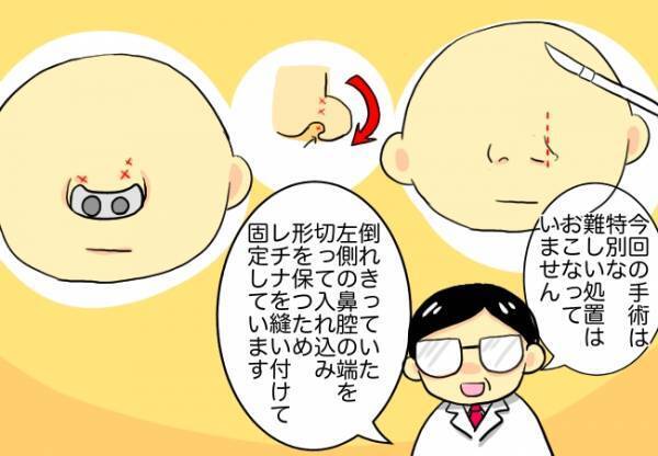 ＜口唇口蓋裂＞「徹底しないと戻ってしまいます」先生の言葉に使命感を強く感じて…