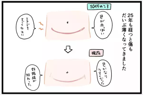 ＜卵巣が巨大化！？＞「お風呂で見てやろ〜」性悪な同級生が陰でコソコソ。私を助けてくれたのは…